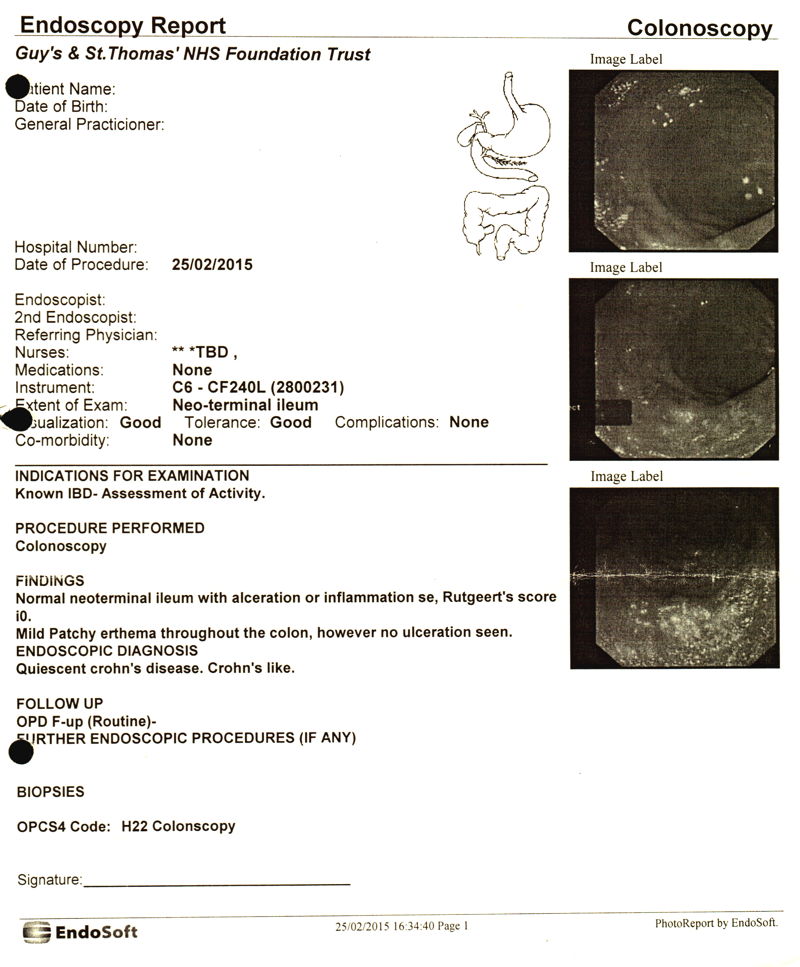 Colonoscopy Report - 25th February 2015