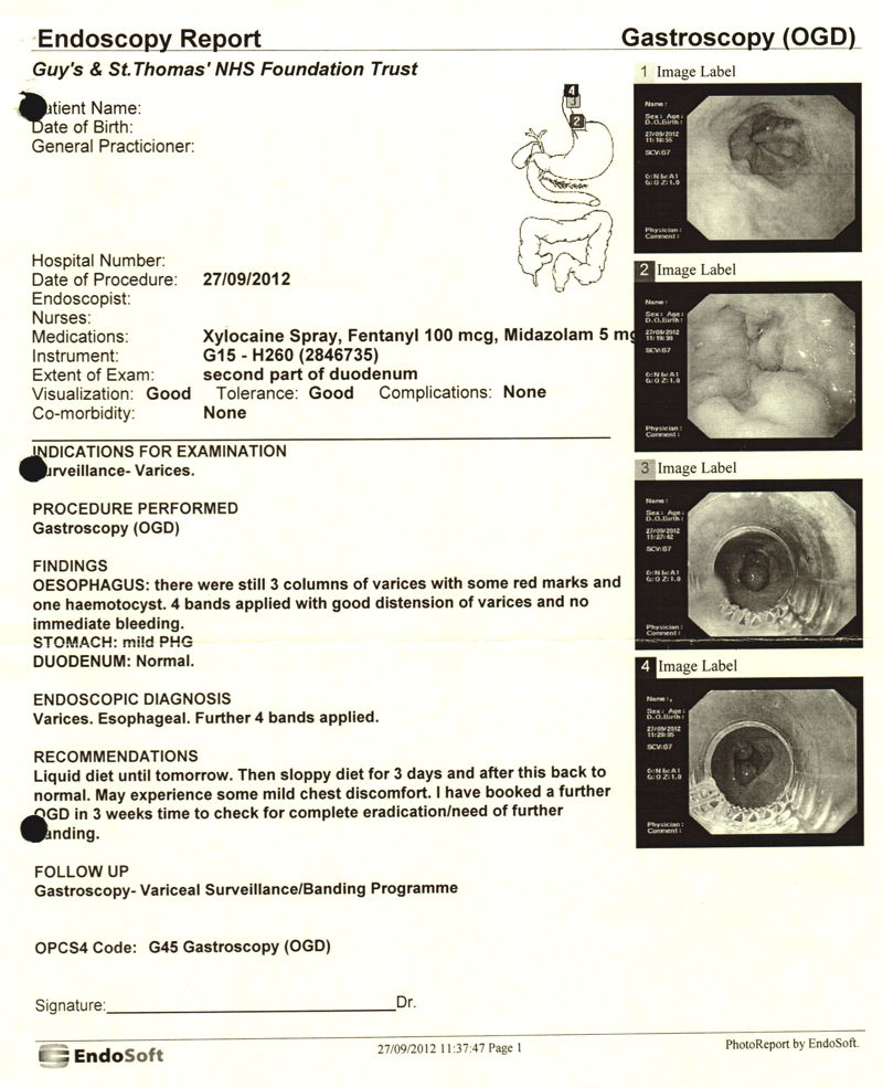 Gastroscopy OGD Report - 27th September 2012