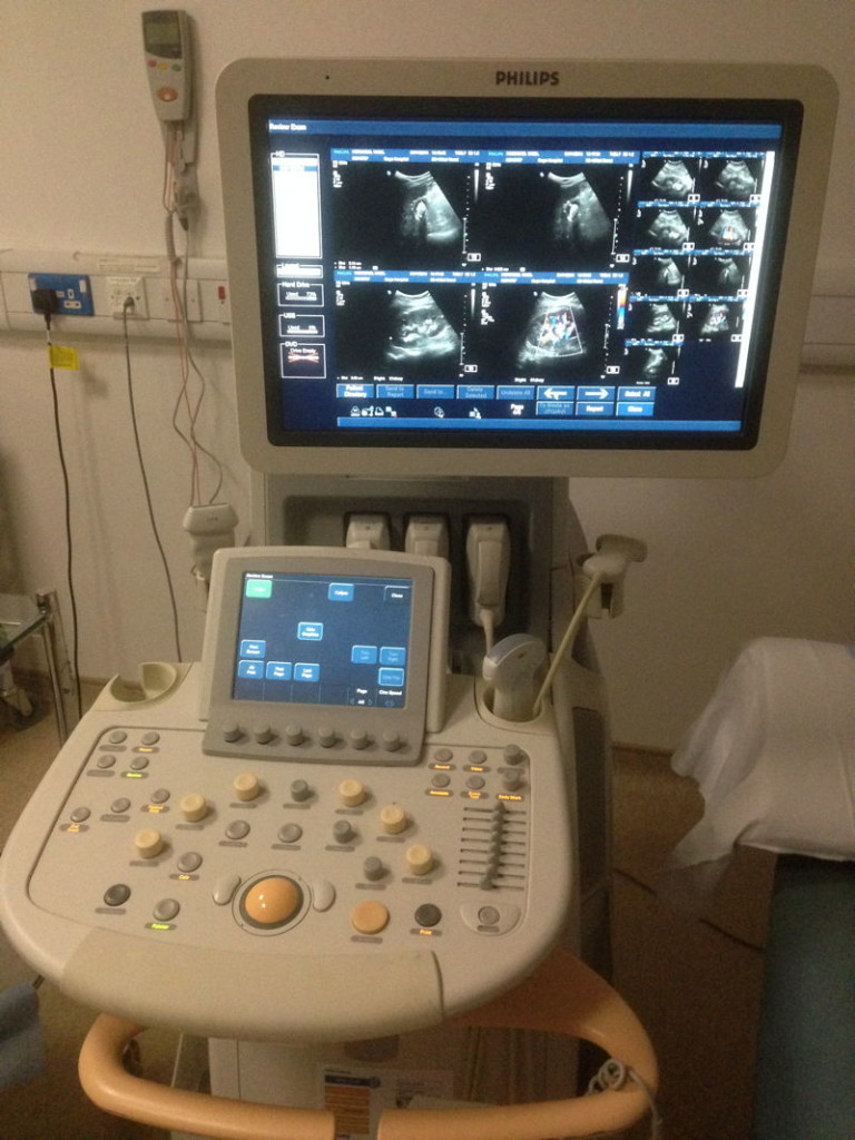 Ultrasound scanner showing results
