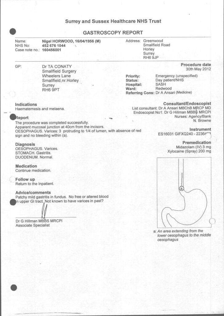 Gastroscopy report ESH - 30th May 2012